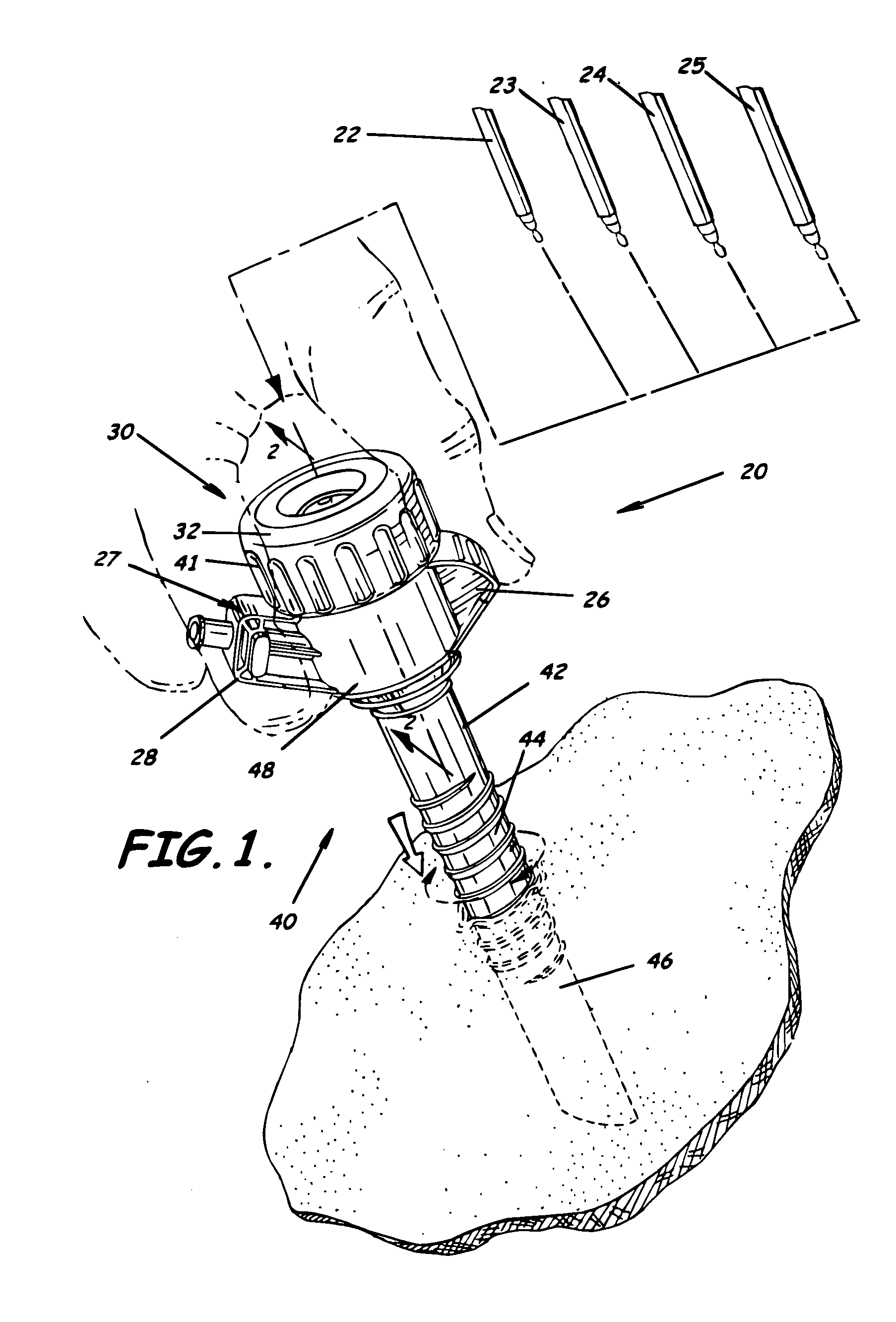 Trocar and cannula assembly having conical valve and related methods