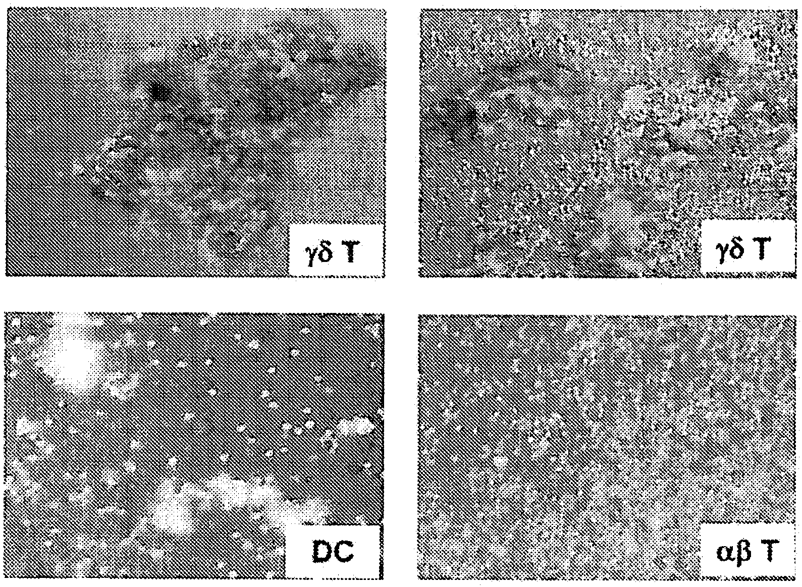 Preparation of antigen-presenting human gamma delta t cells and use in immunotherapy