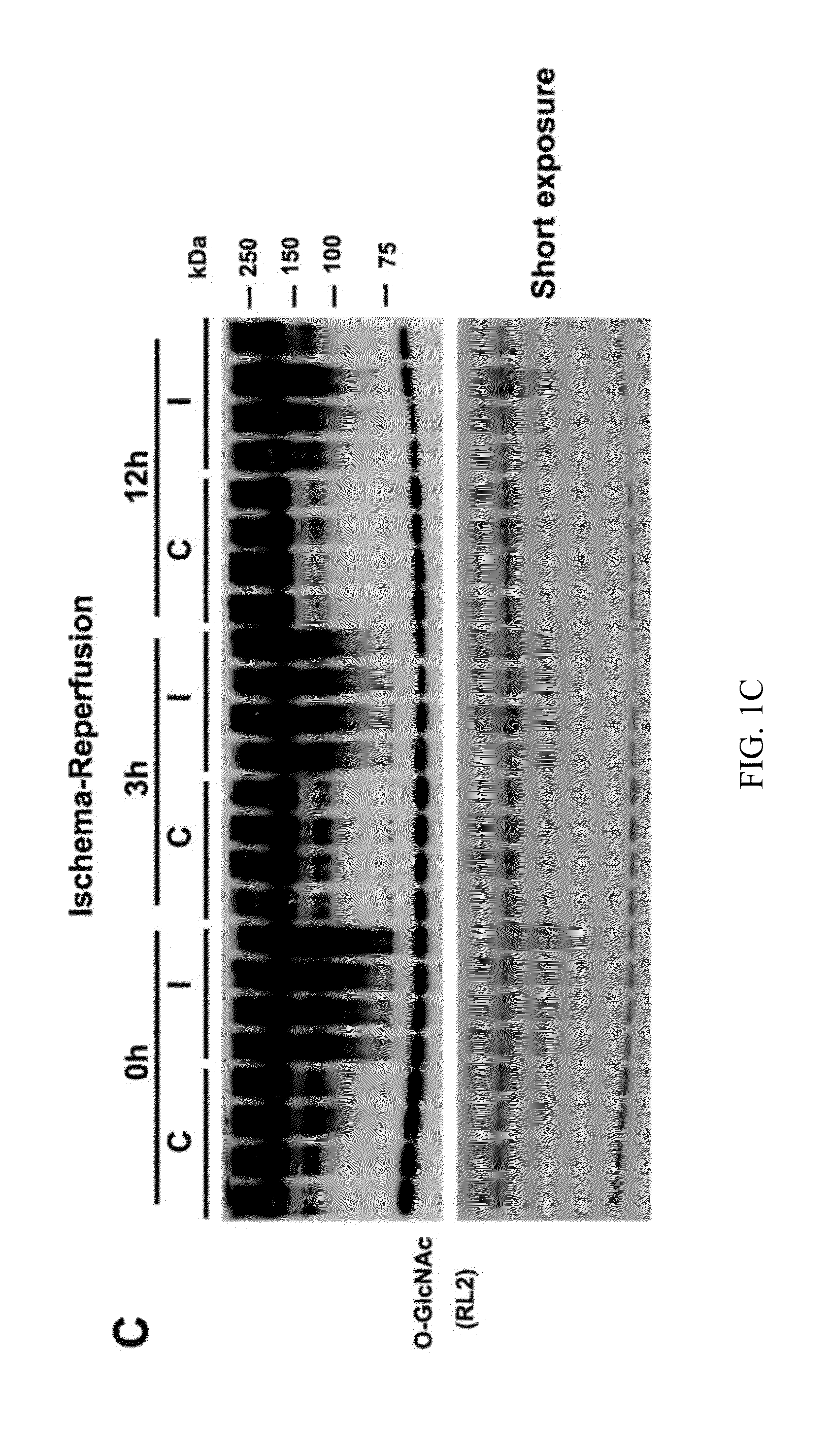 O-glcnacylation treatment for ischemic brain injury