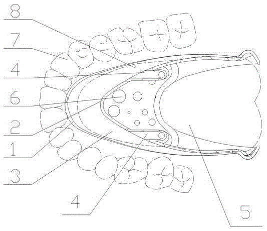 Oral cavity inner protecting tongue supporting frame