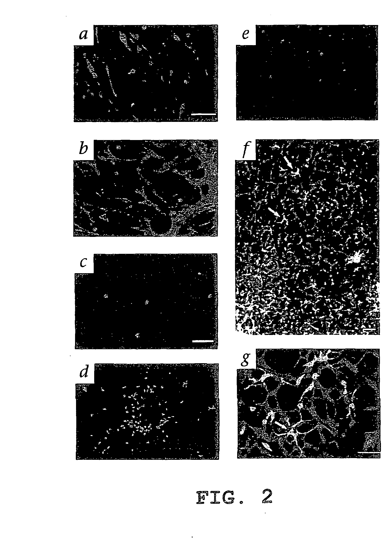 Hematopoietic stem cells and methods of treatment of neovascular eye diseases therewith