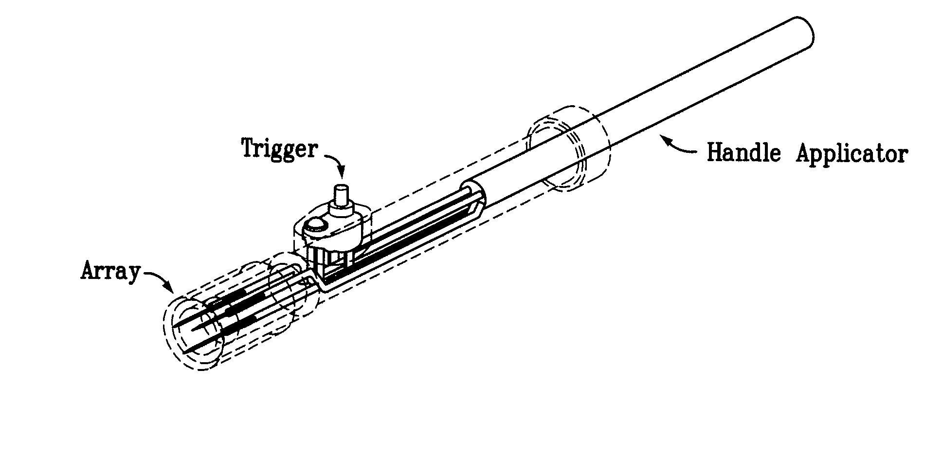 Electroporation devices and methods of using same for electroporation of cells in mammals