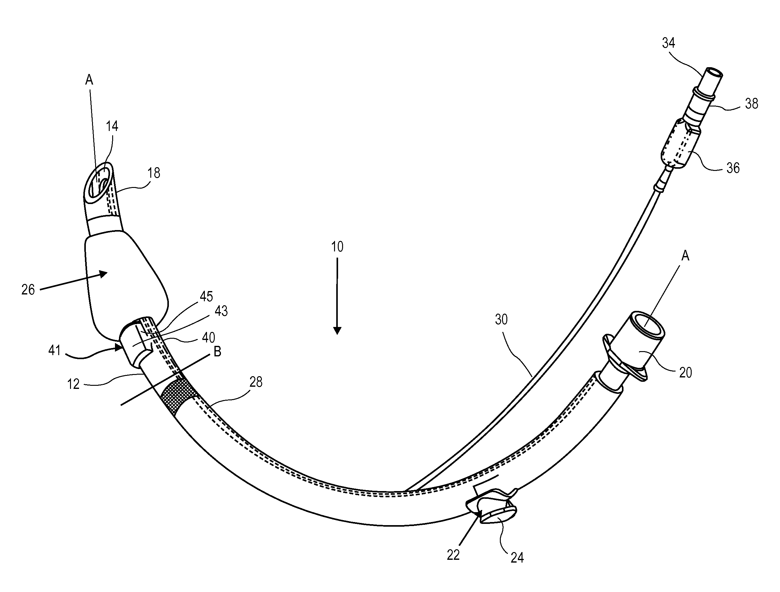 Endotracheal tube with dual port subglottic secretion suctioning