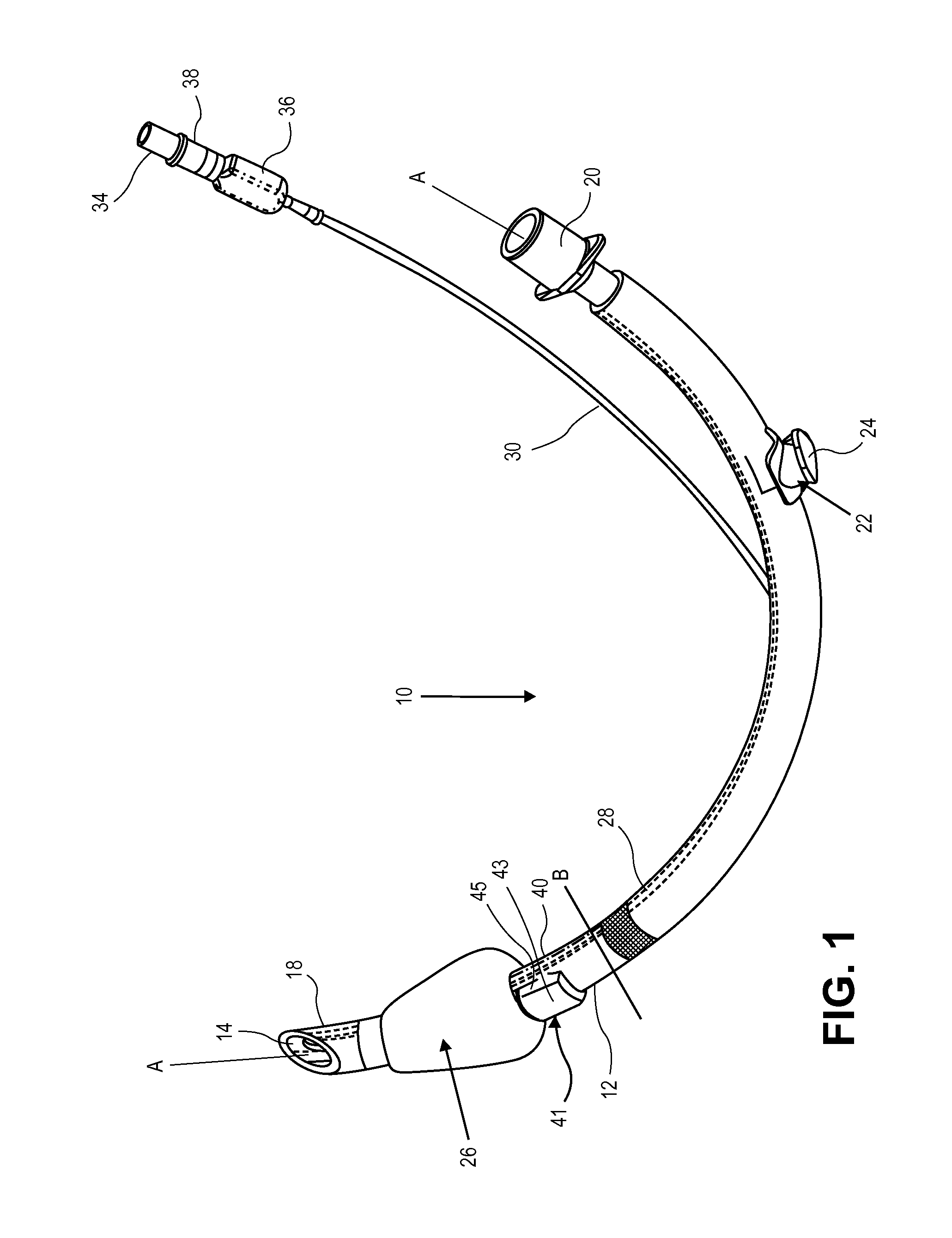 Endotracheal tube with dual port subglottic secretion suctioning