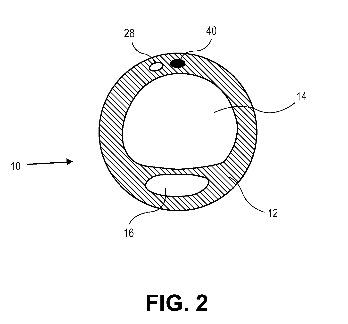 Endotracheal tube with dual port subglottic secretion suctioning