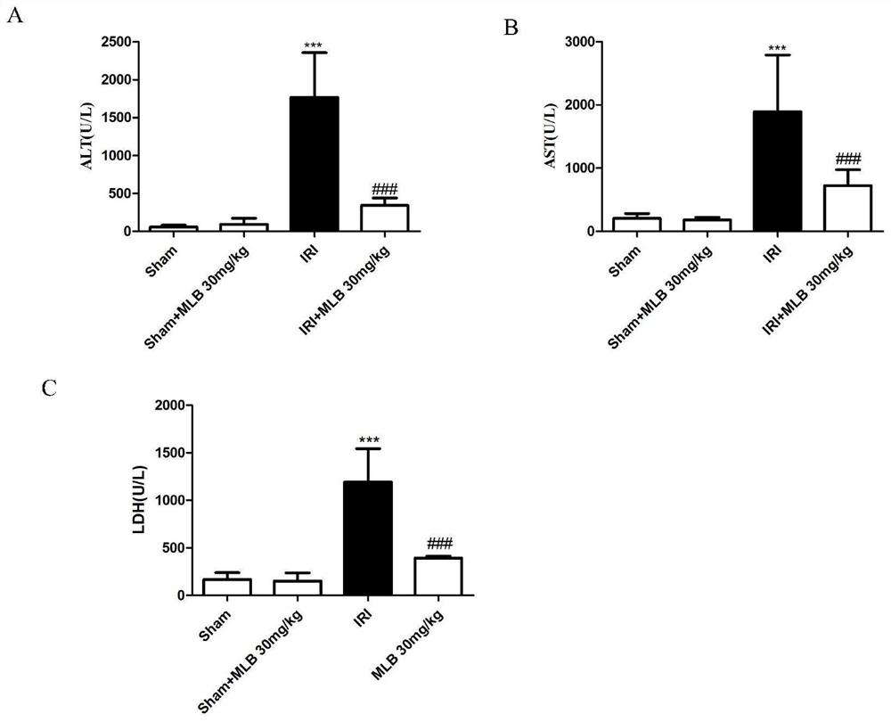 Protective effect and application of magnesium lithospermate B or pharmaceutical composition containing lithospermate B on hepatic ischemia reperfusion