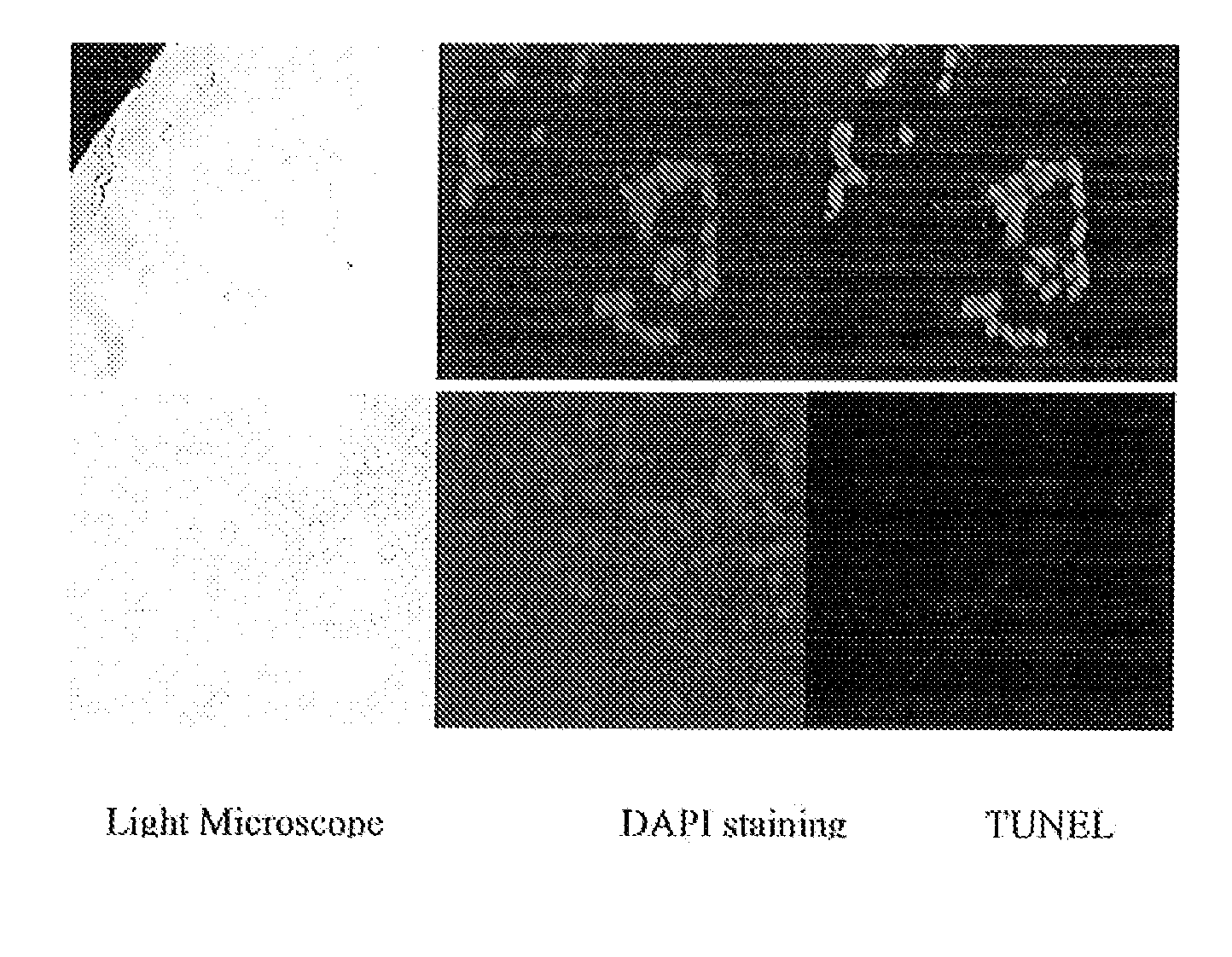 Fragments of antibodies to epidermal growth factor receptor and methods of their use