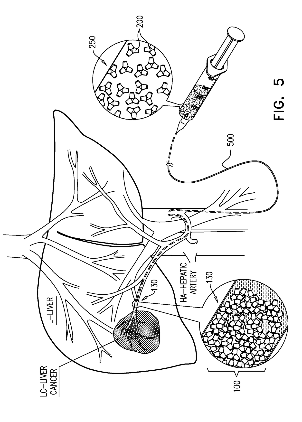 Embolization particulates for occluding a blood vessel