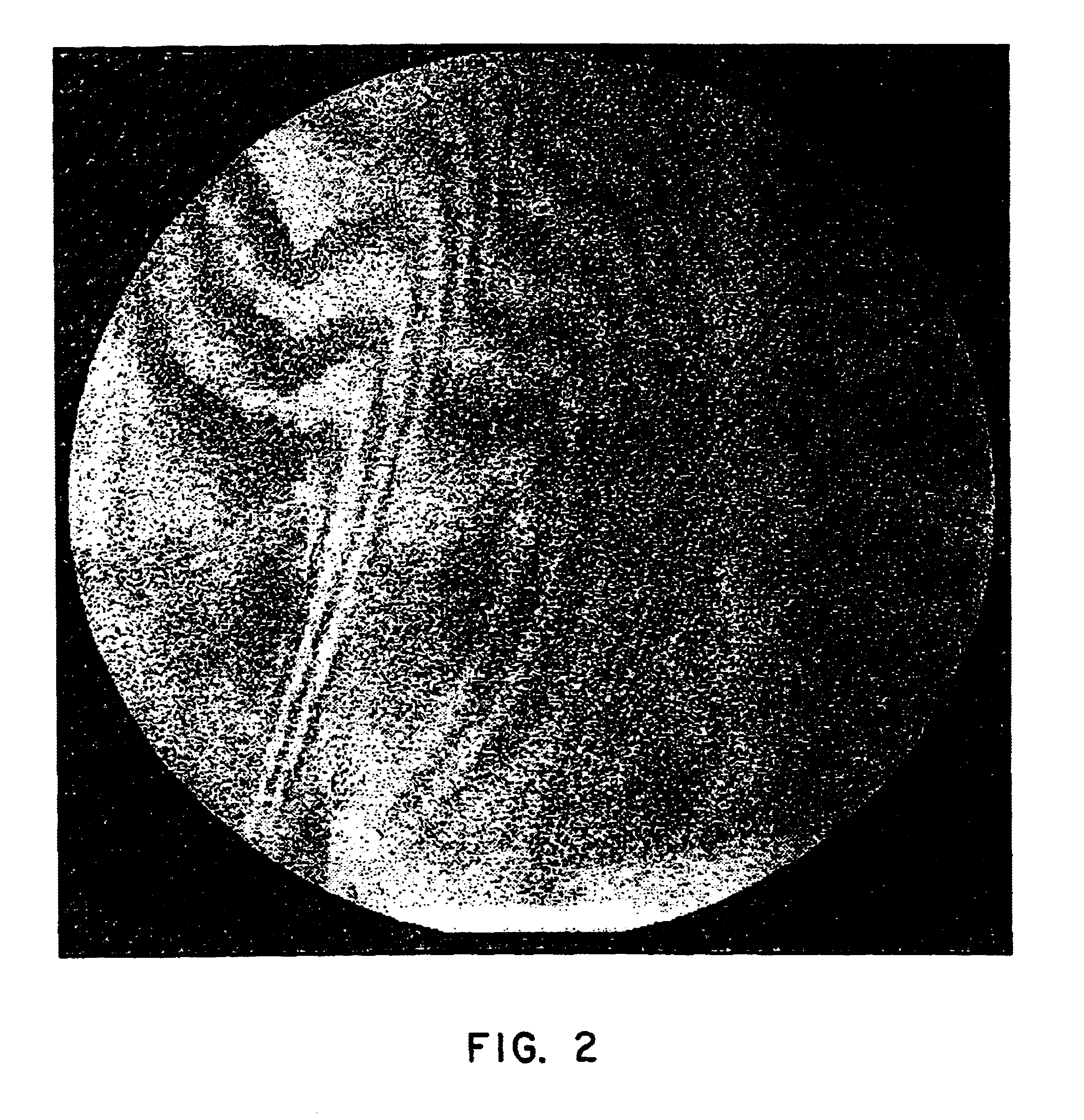 Shadow moire surface measurement using Talbot effect