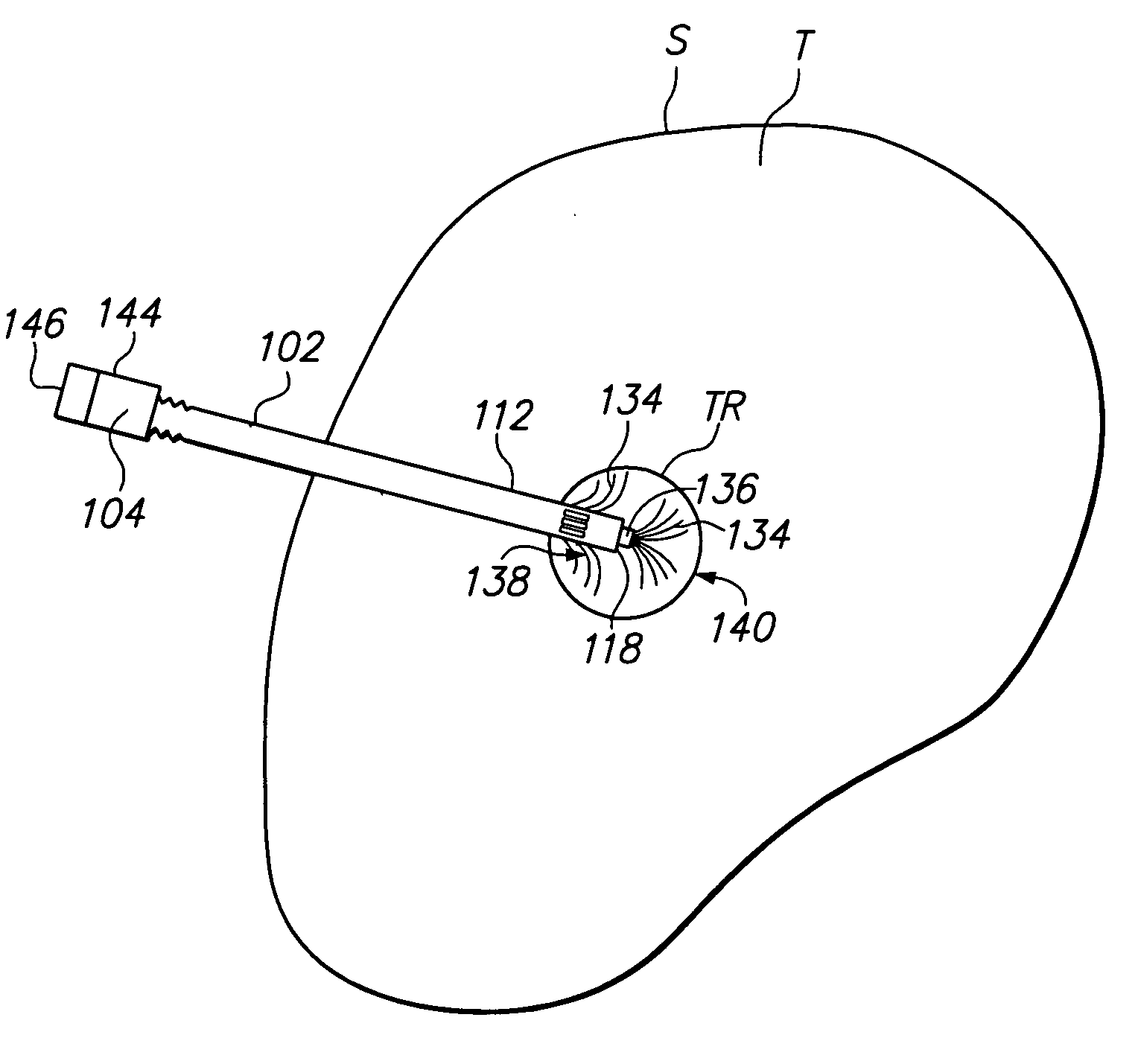 Co-access bipolar ablation probe