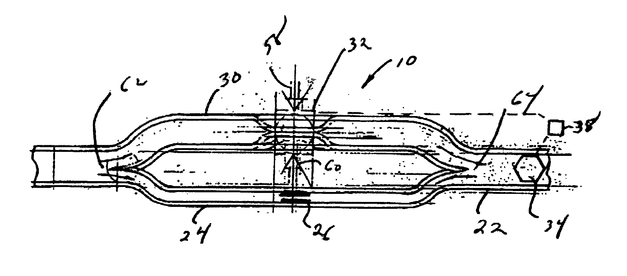 Phaco aspiration flow restrictor with bypass tube