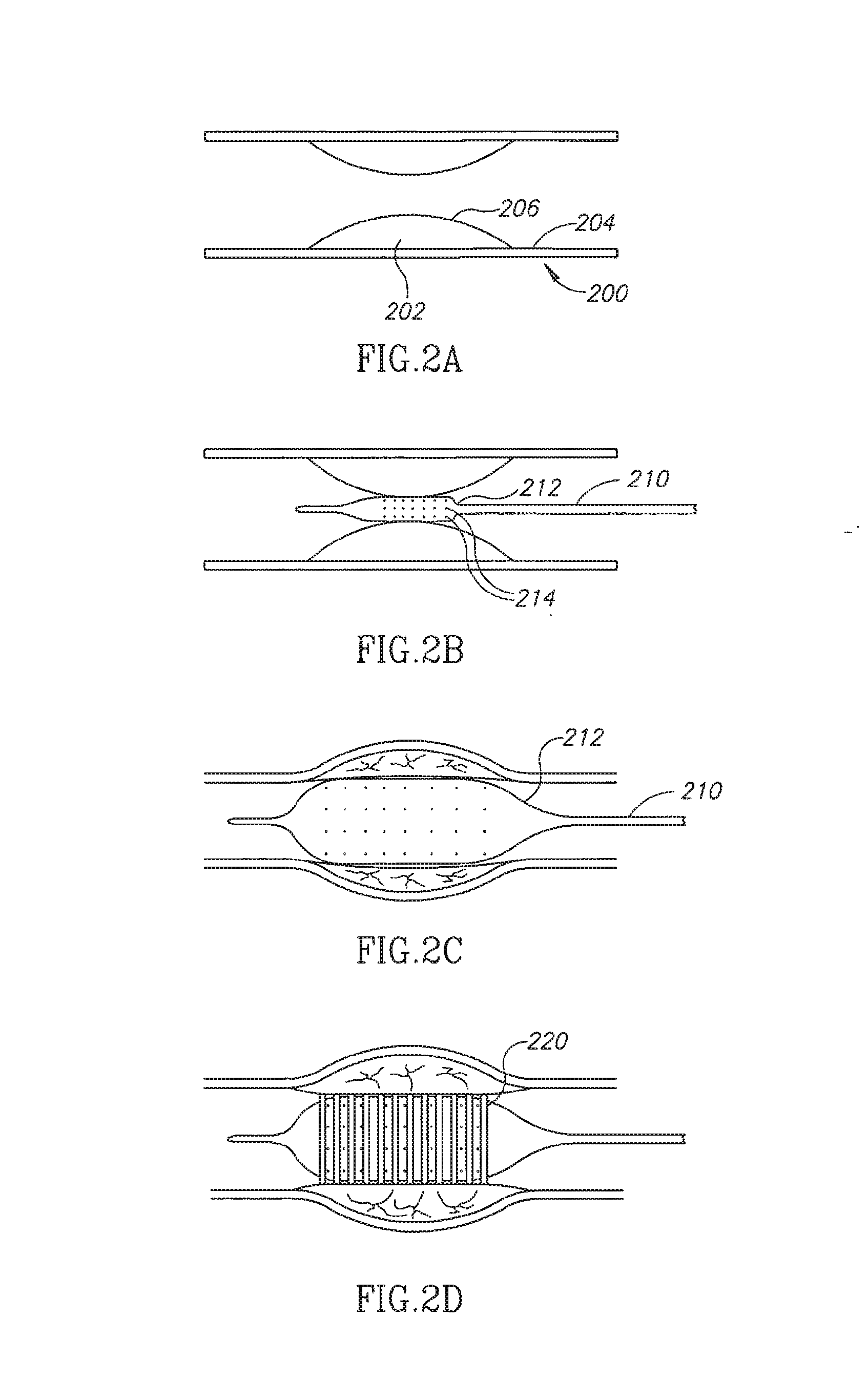 Material delivery system