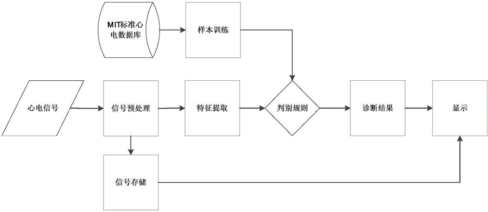 ECG (electrocardiogram) diagnosis system based on chaos features