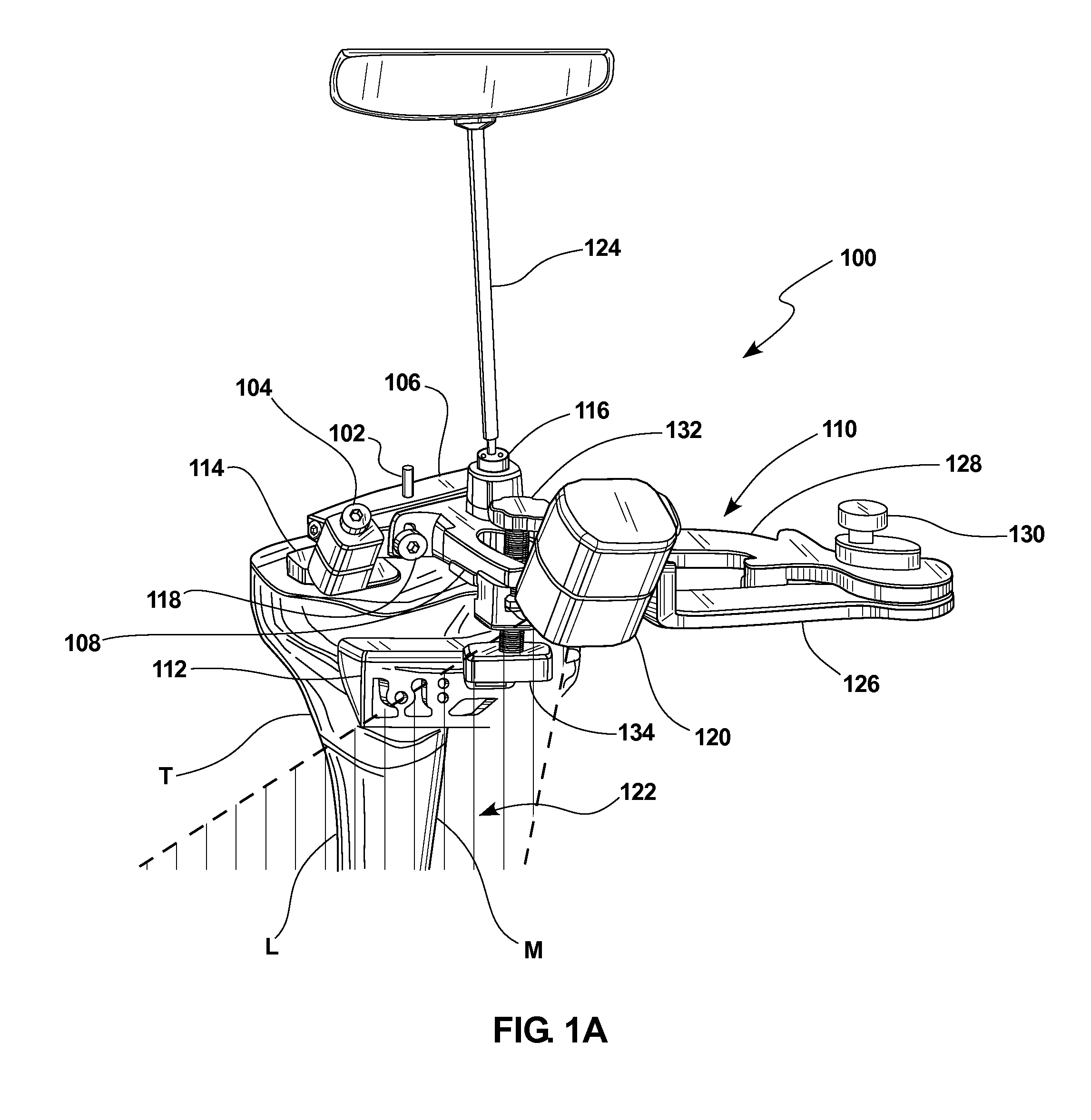 Knee arthroplasty apparatus and method