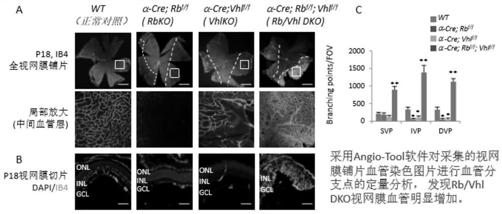 A method for constructing retinal hemangioma-like hyperplasia and/or retinal capillary hemangioma model