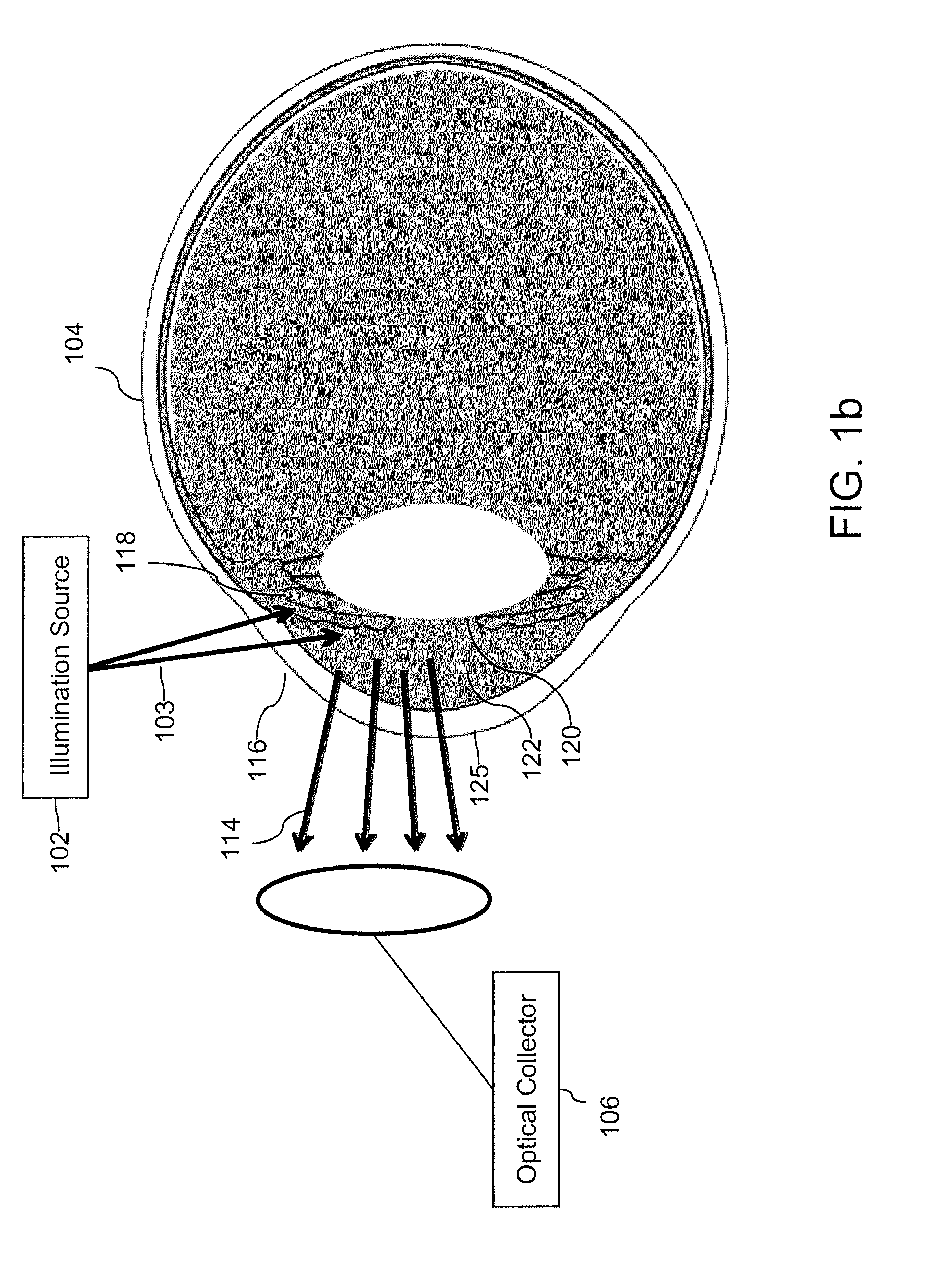 Non-invasive ocular monitoring