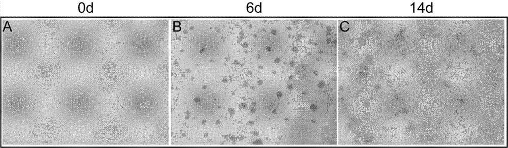 Cord blood regulative T-cell in-vitro amplification method