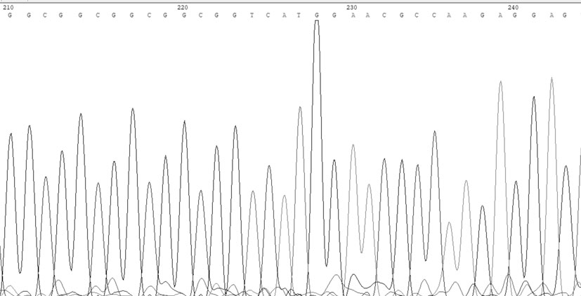 Reagent for in-vitro detection on mutation of SelS gene promoter and application of reagent in preparation of coronary heart disease screening kit