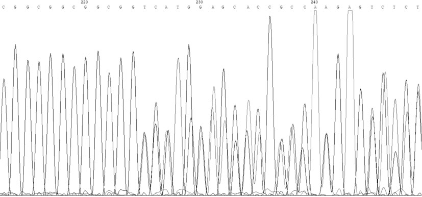 Reagent for in-vitro detection on mutation of SelS gene promoter and application of reagent in preparation of coronary heart disease screening kit