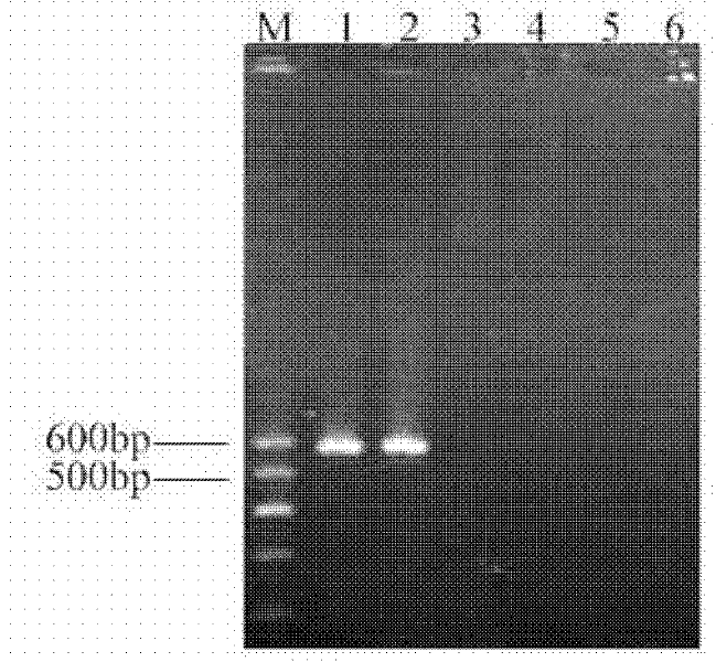 Primers for detecting sugarcane rust and detection method thereof