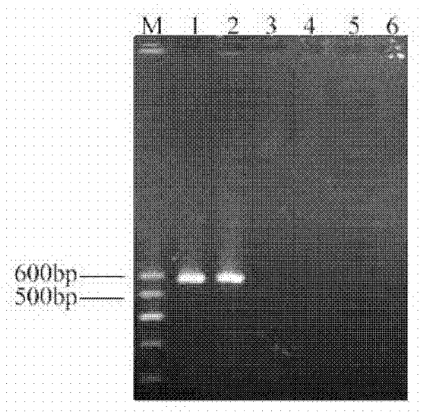 Primers for detecting sugarcane rust and detection method thereof