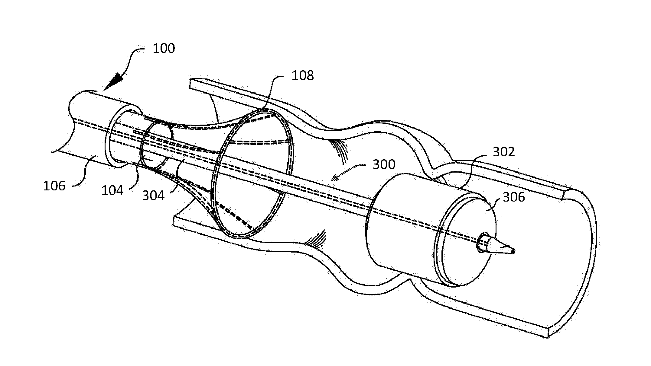 Valve replacement devices and methods