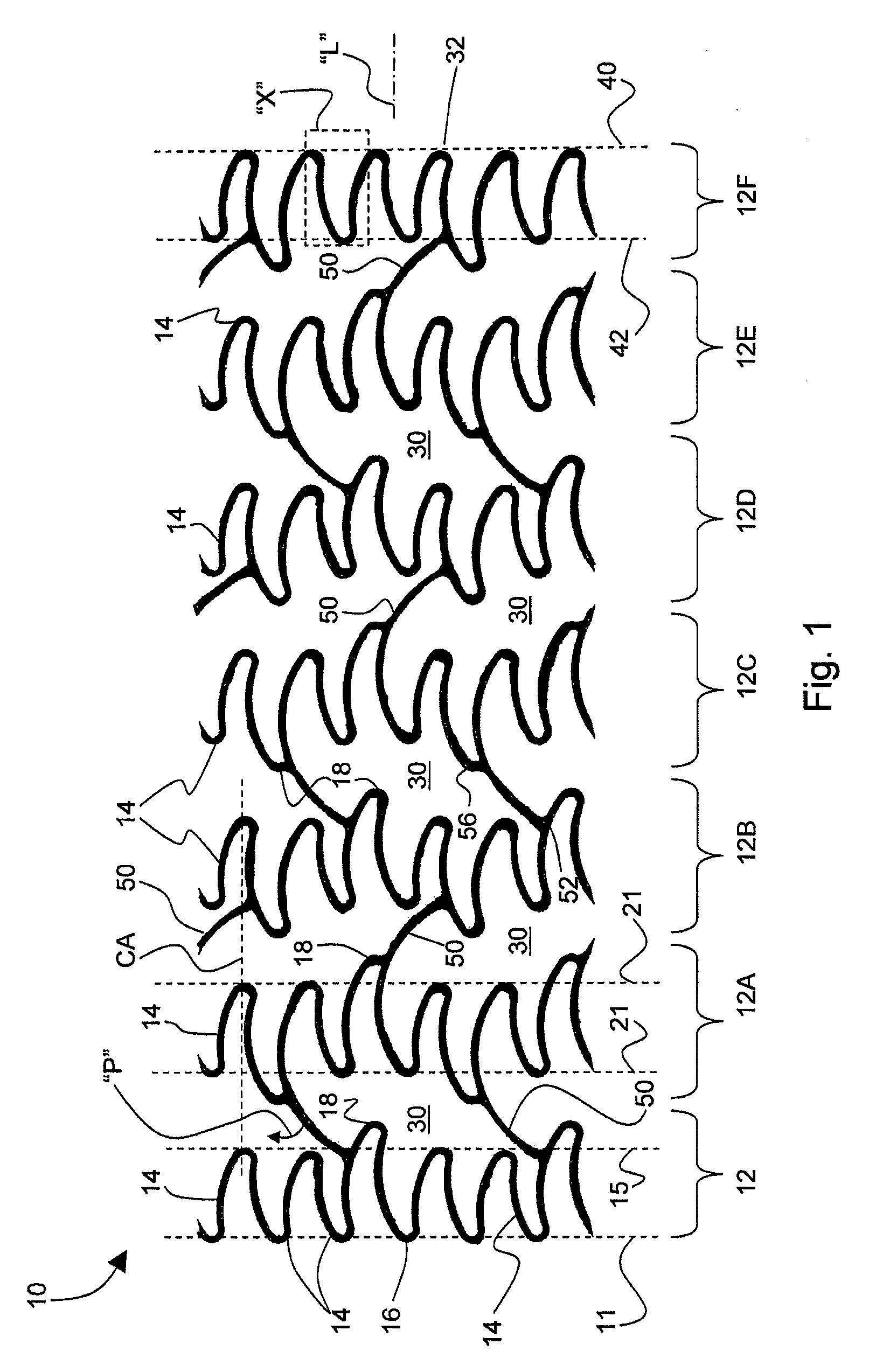 Flexible expandable stent