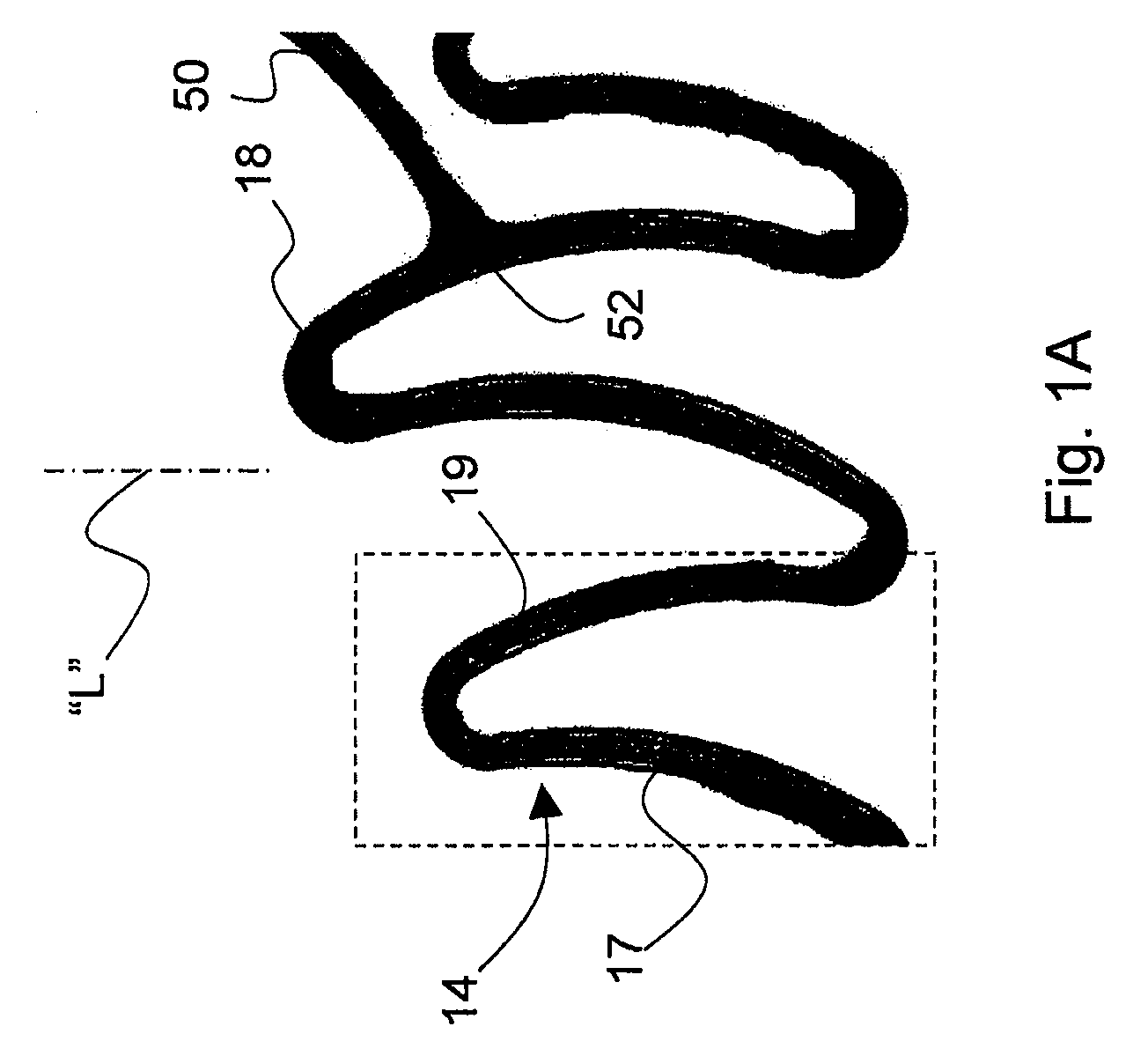 Flexible expandable stent