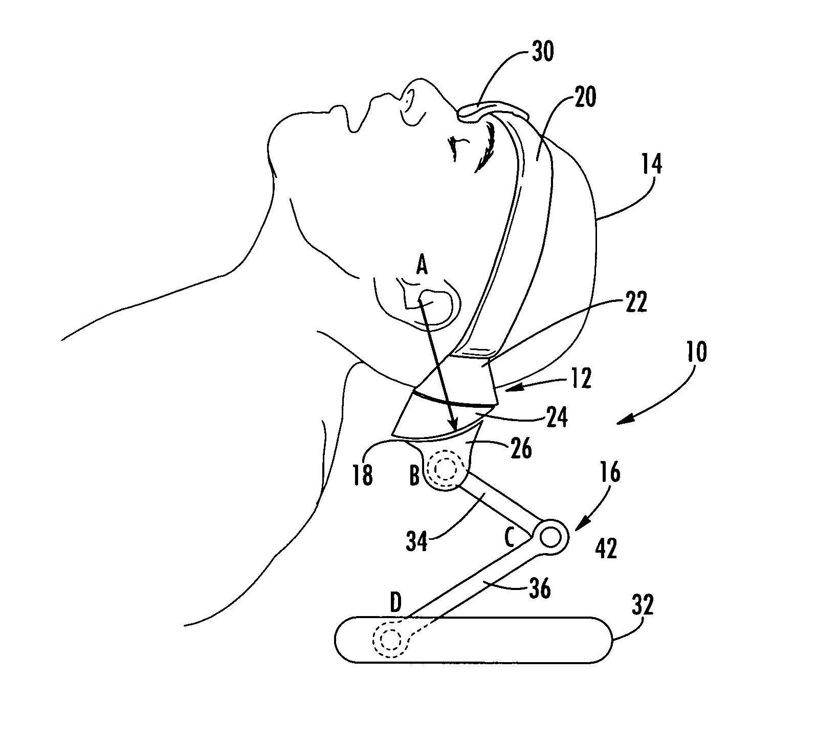 Head positioning device