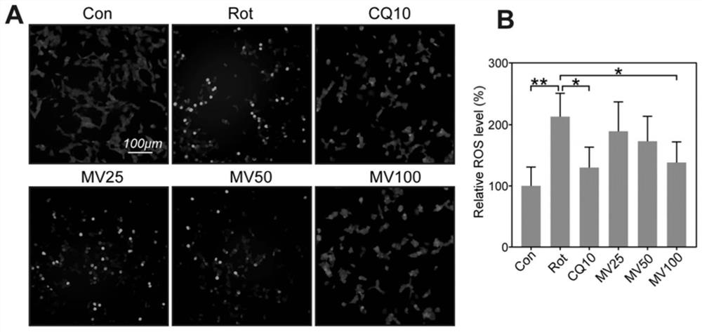 Application of mogroside V (MV) in preparation of medicine with protection effect on neuronal injury caused by Parkinson's disease (PD)