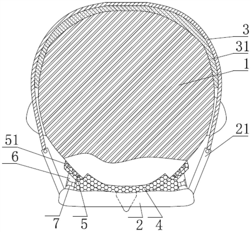 Anti-shedding and anti-infection goggles for medical use