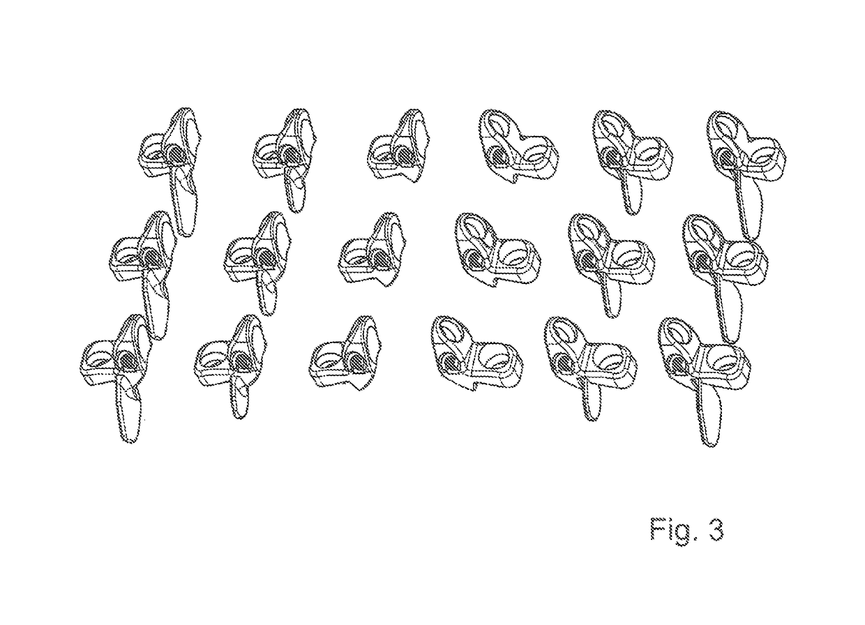 Reinforcement implant for lamina with a cantilever bridge part