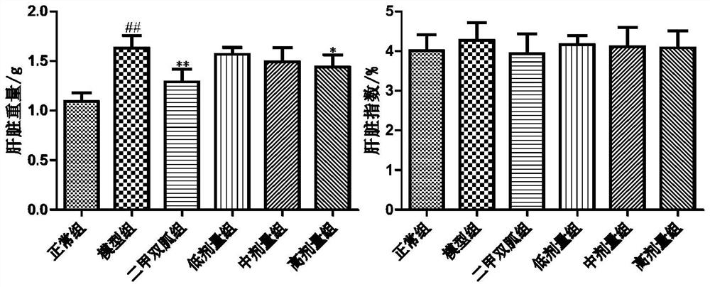 Extraction method of rape pollen total flavonoids and application of rape pollen total flavonoids in preparation of medicine for preventing or treating fatty liver