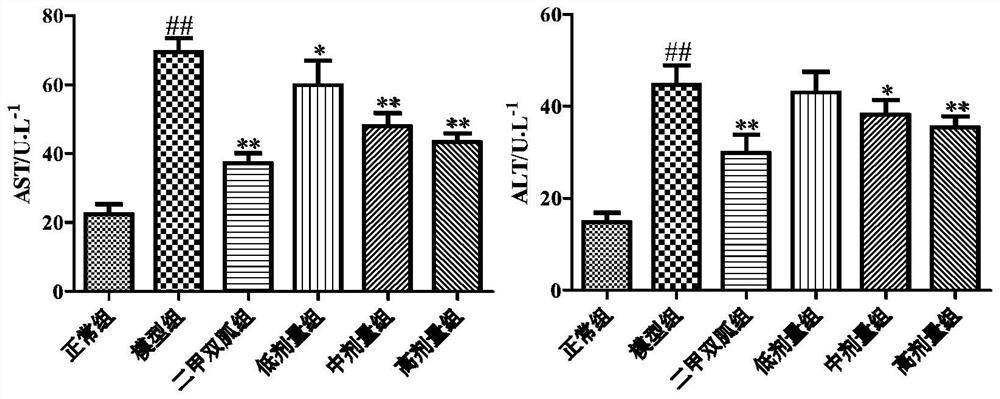 Extraction method of rape pollen total flavonoids and application of rape pollen total flavonoids in preparation of medicine for preventing or treating fatty liver