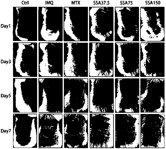 Application of Saikosaponin a in Preparation of Drugs for Preventing and Treating Psoriasis