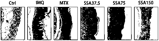 Application of Saikosaponin a in Preparation of Drugs for Preventing and Treating Psoriasis