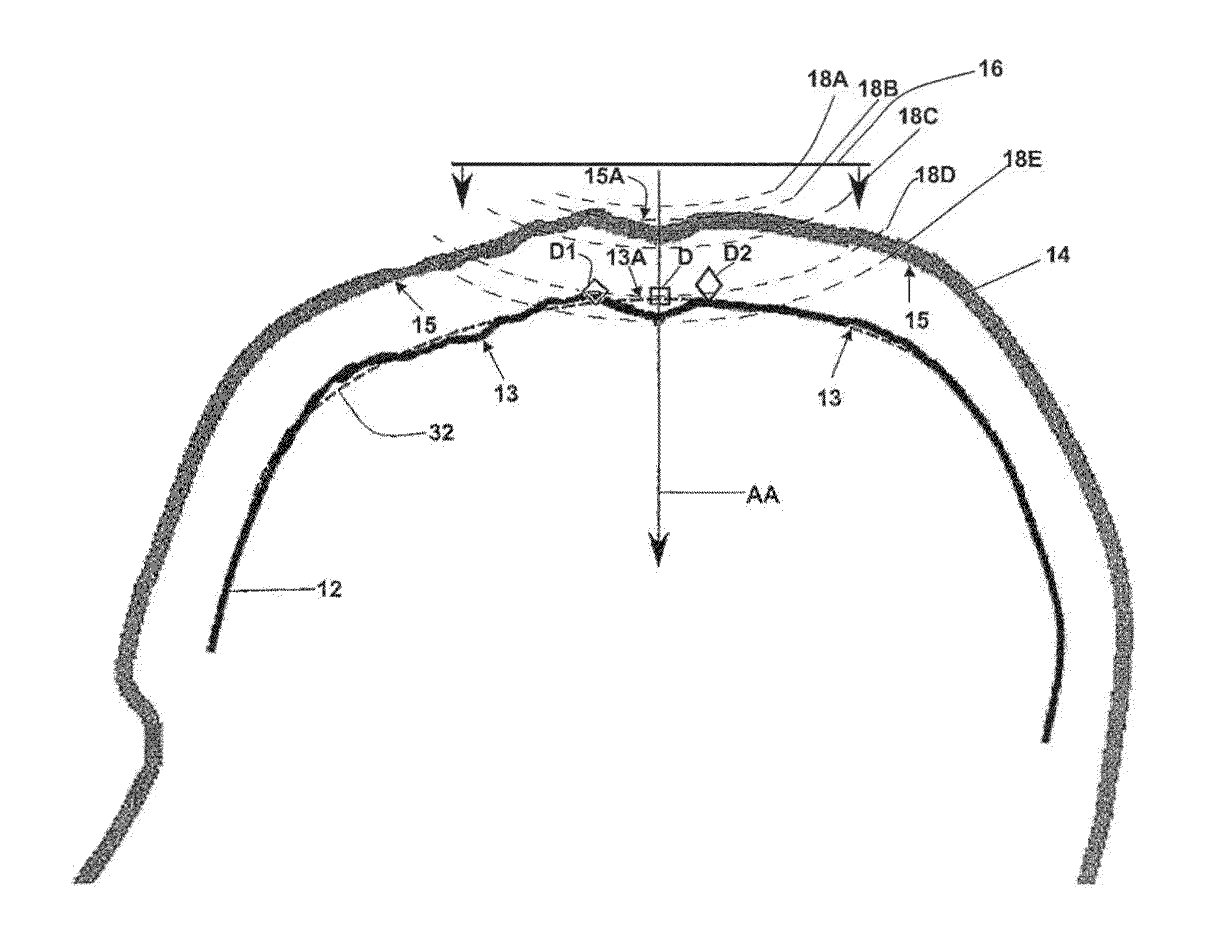 Method and system for displaying the electric field generated on the brain by transcranial magnetic stimulation