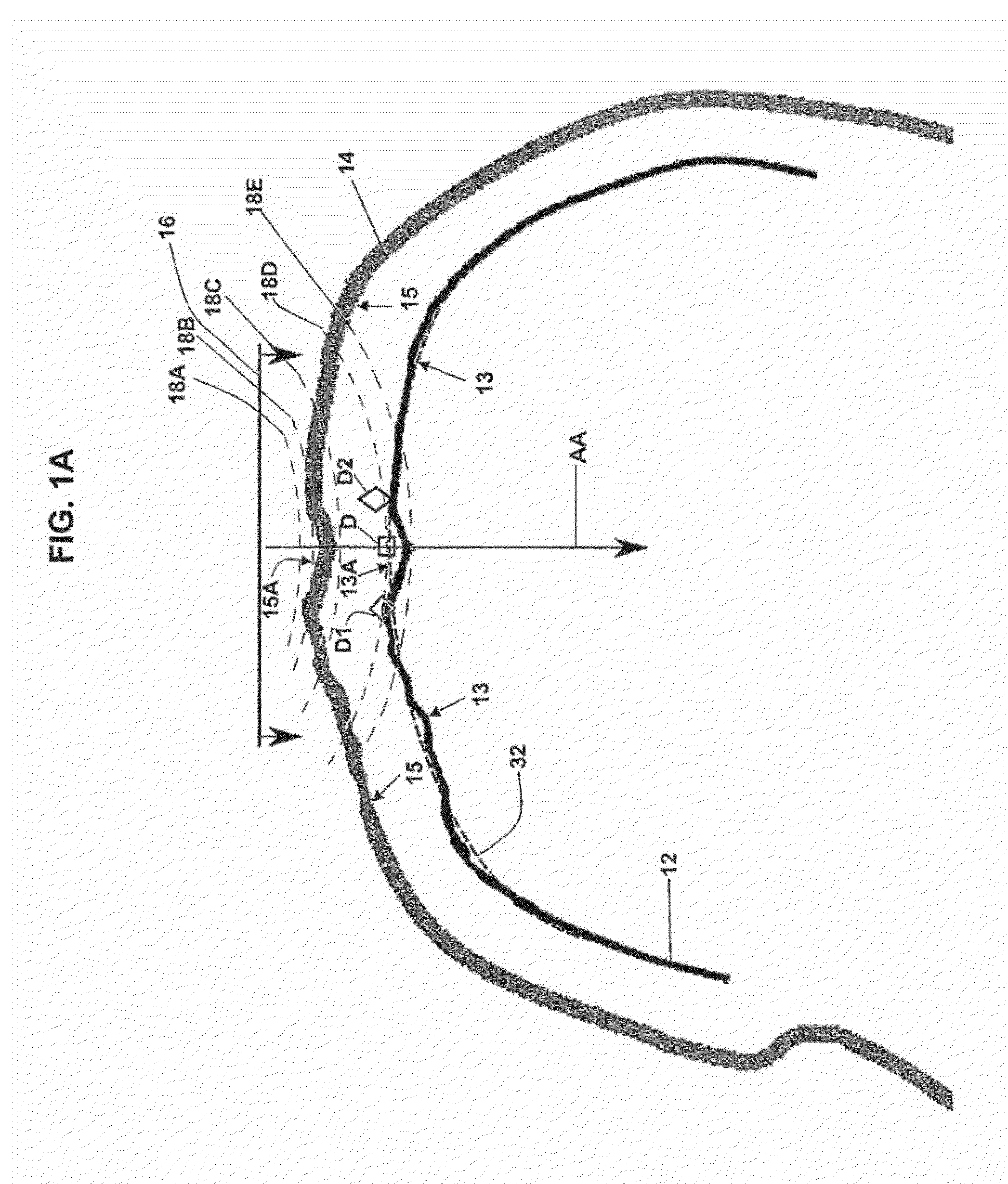 Method and system for displaying the electric field generated on the brain by transcranial magnetic stimulation