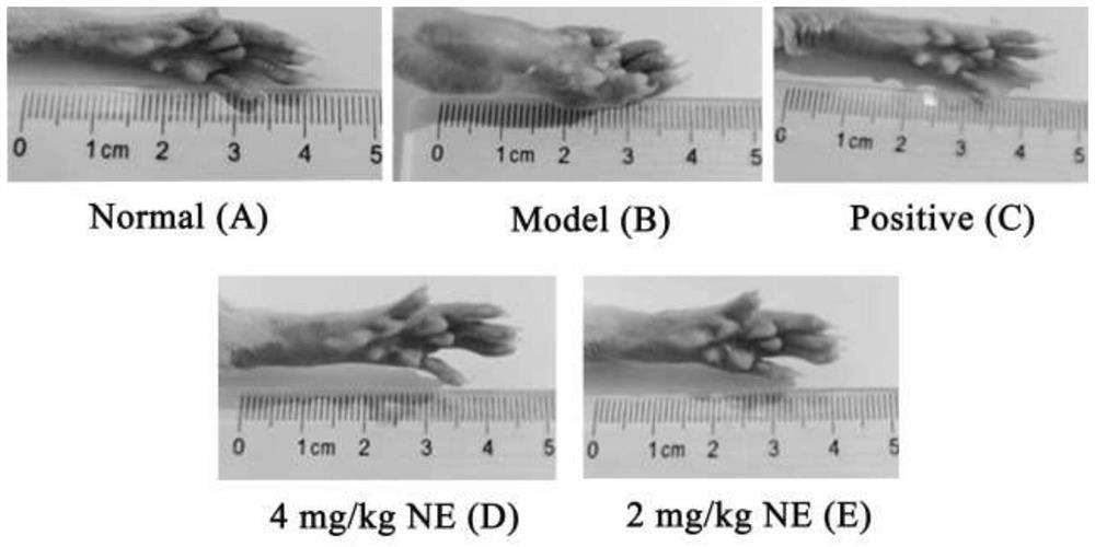 Application of neauline in preparation of medicine for treating arthritis