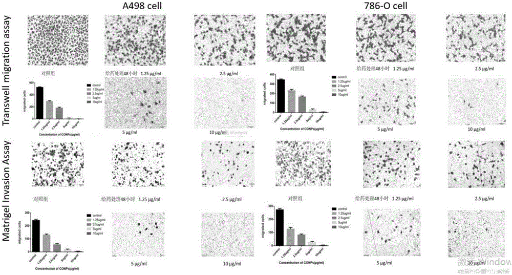 Application of cuprous oxide nanoparticles to preparation of medicine for treating renal cancer diseases