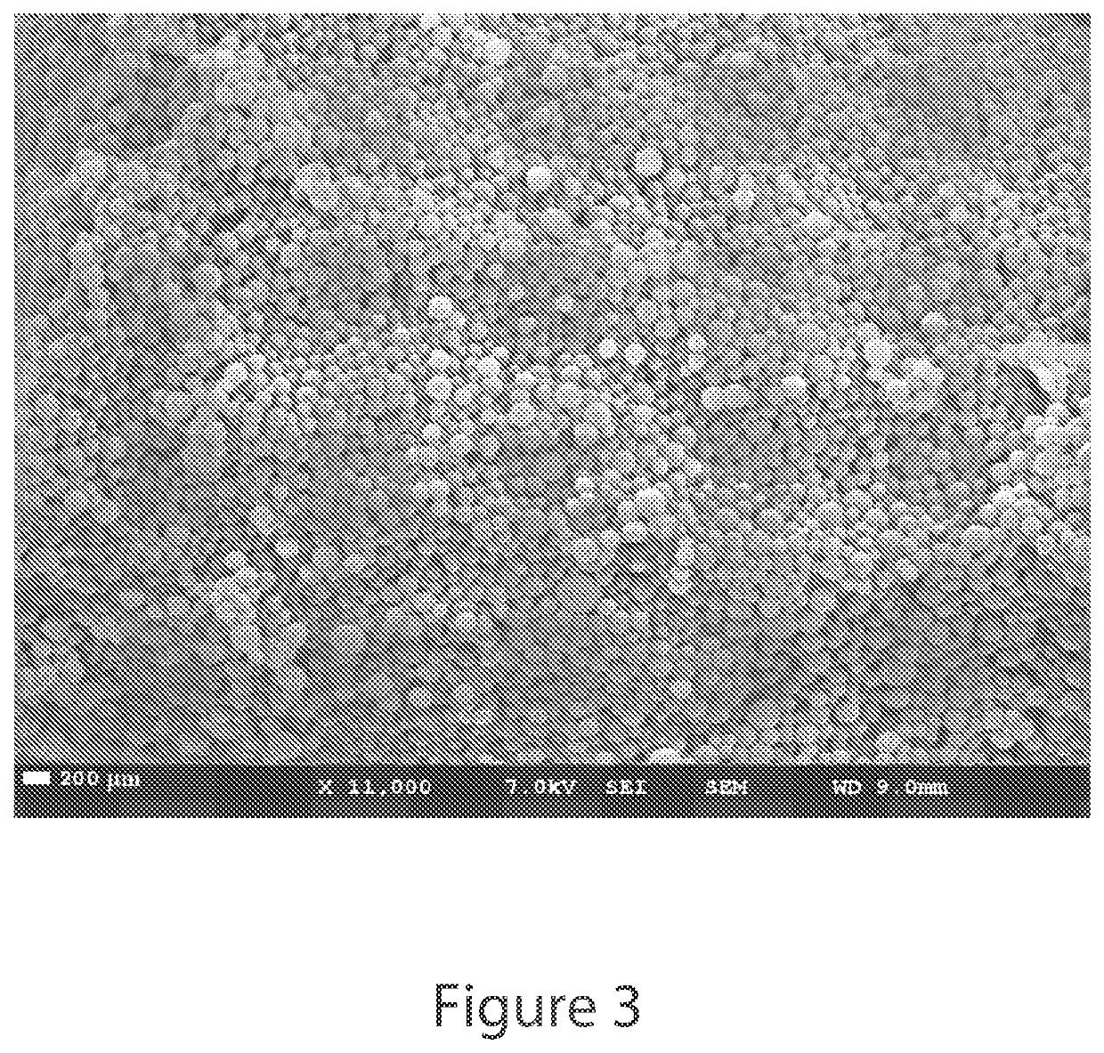 Octreotide Microsphere-Based Arterial Embolization for Treating Obesity