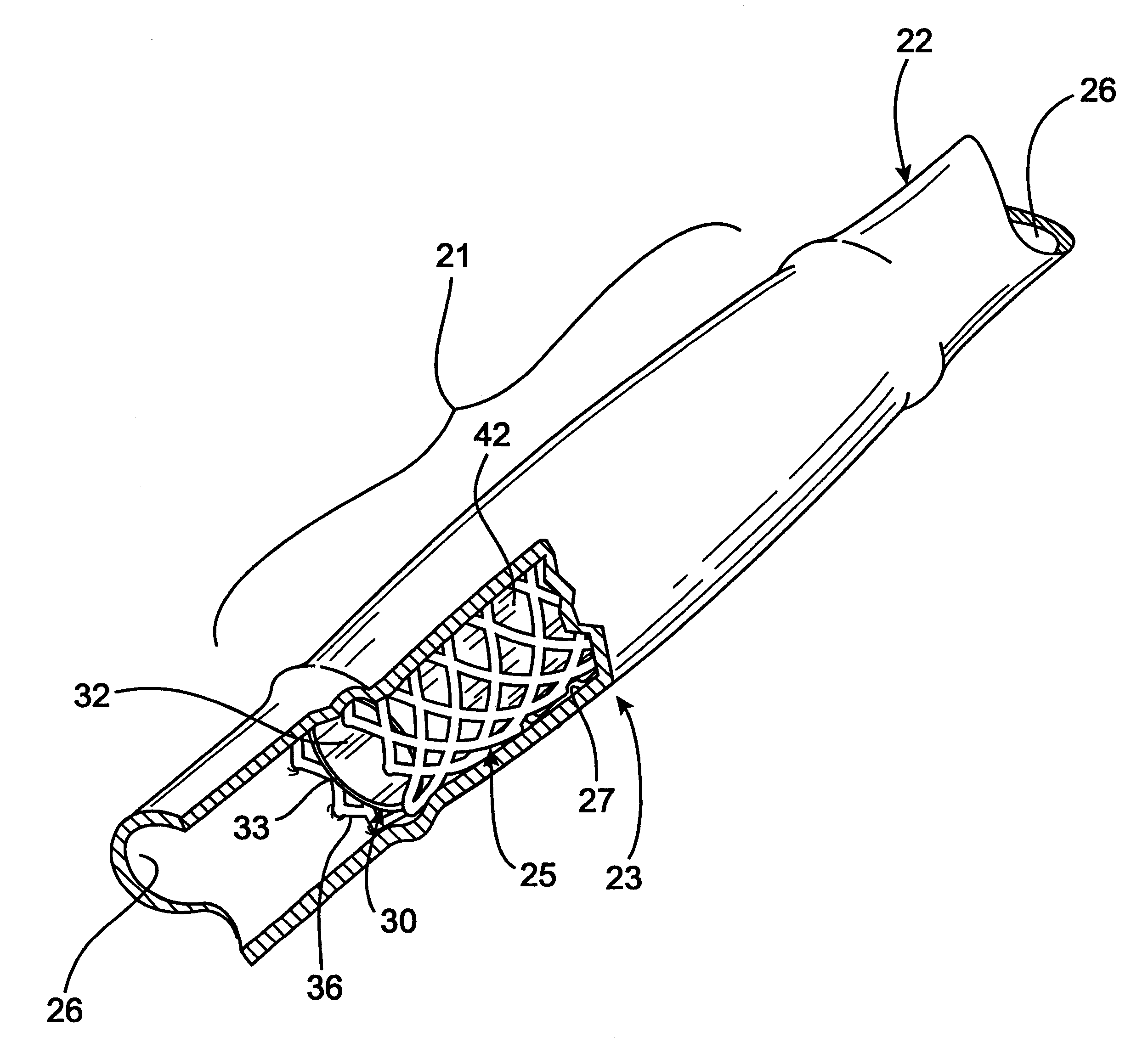 Radioactive intraluminal endovascular prosthesis and method for the treatment of aneurysms