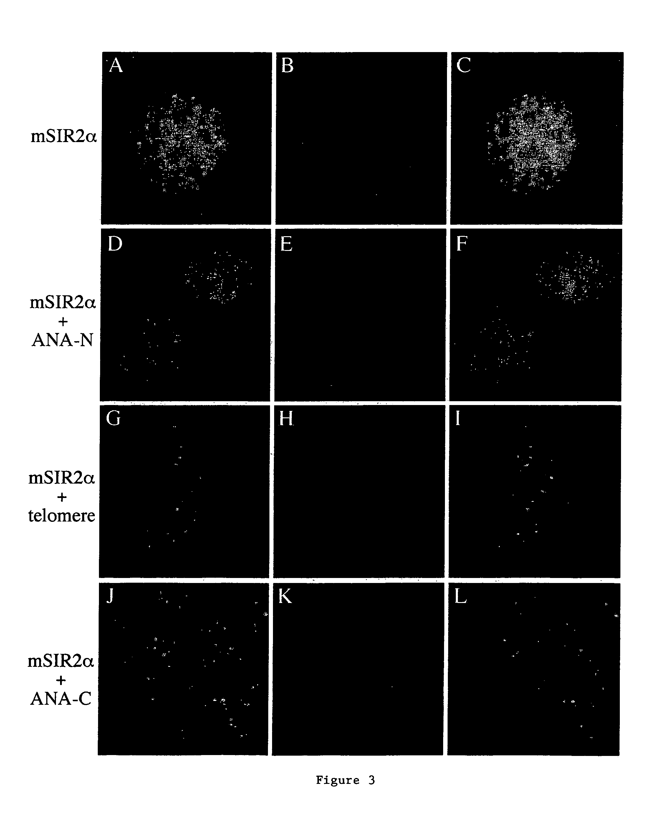 Methods for identifying agents that alter NAD-dependent deacetylation activity of a SIR2 protein