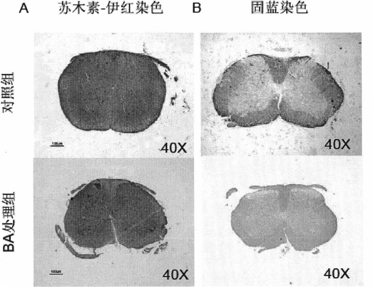 Novel medicinal application of baicalein