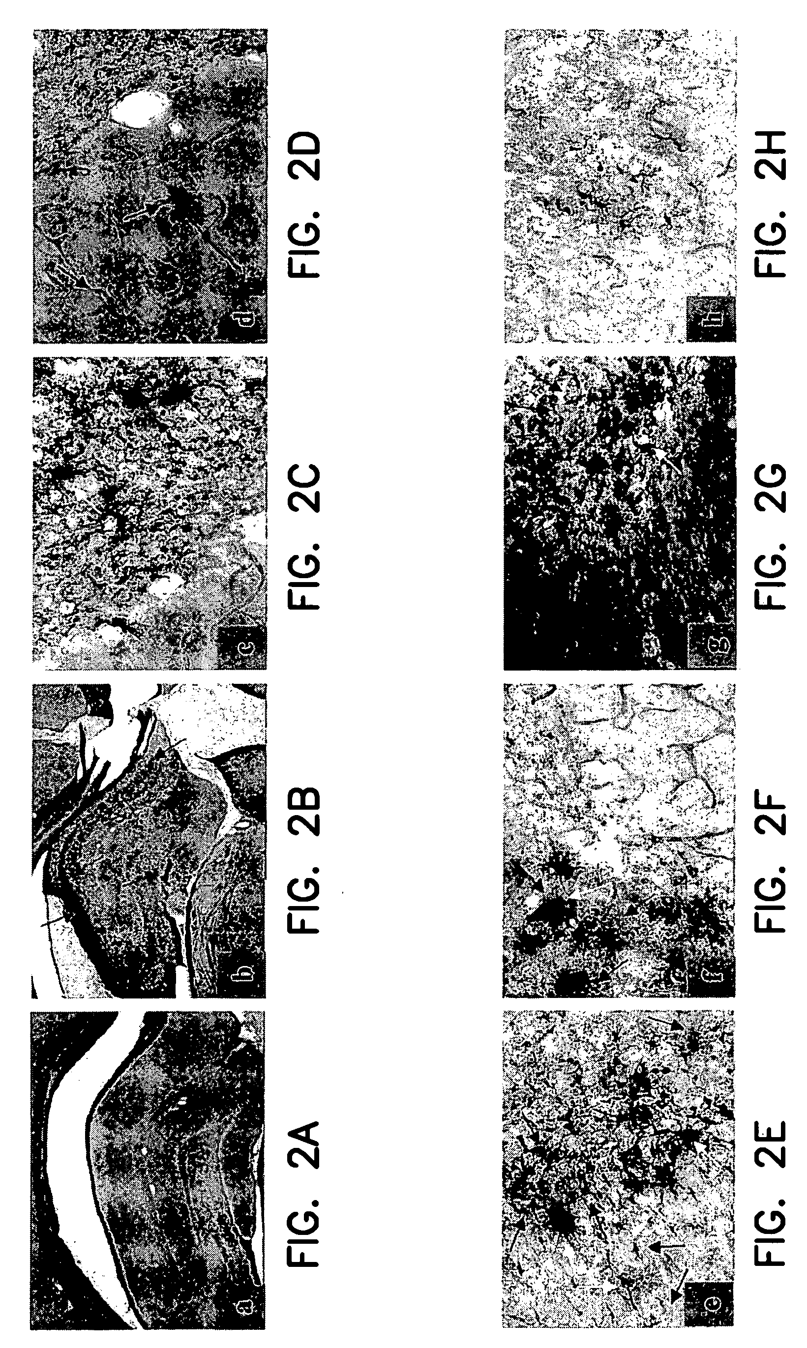 Animal model simulating neurologic disease