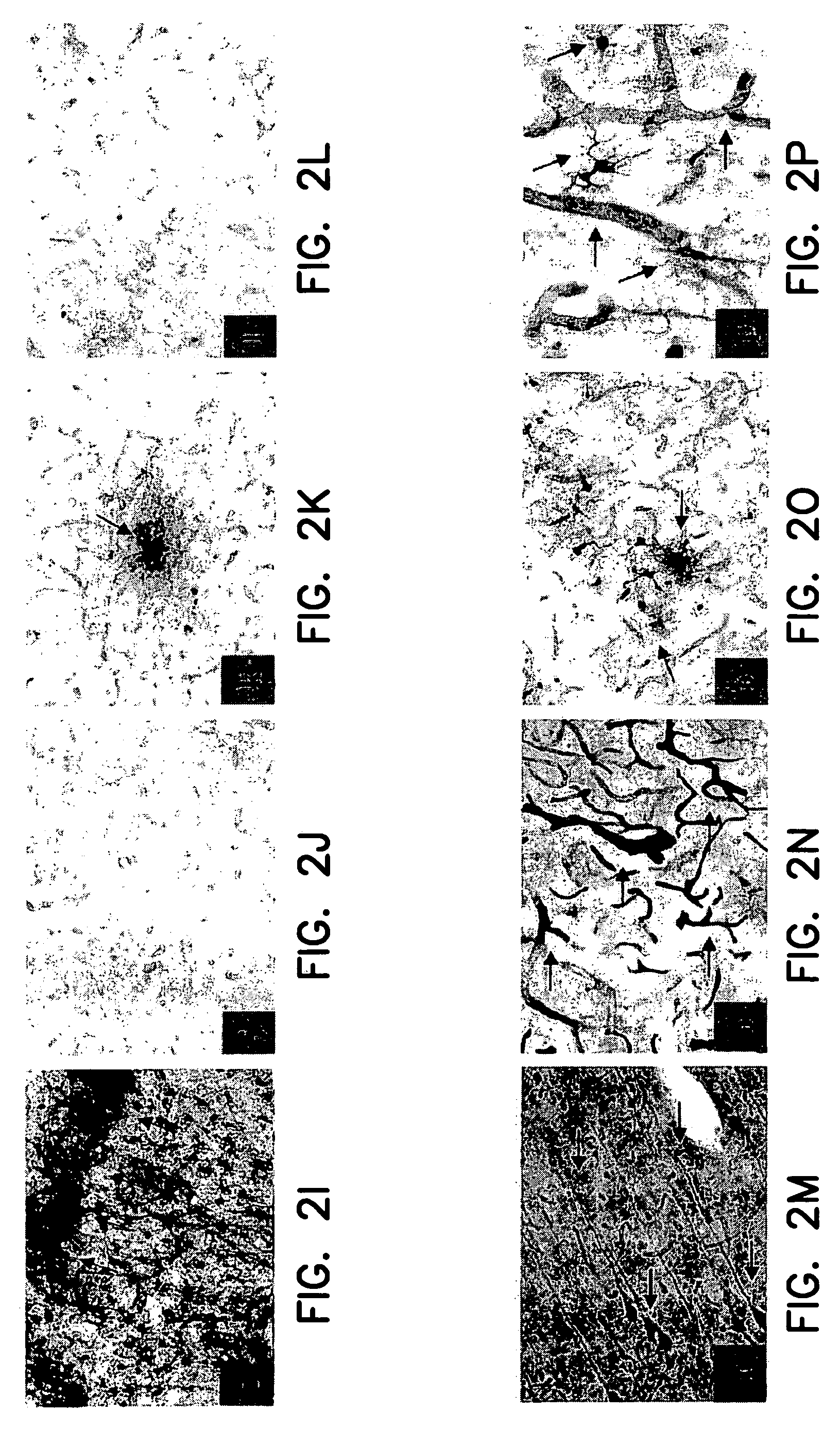 Animal model simulating neurologic disease