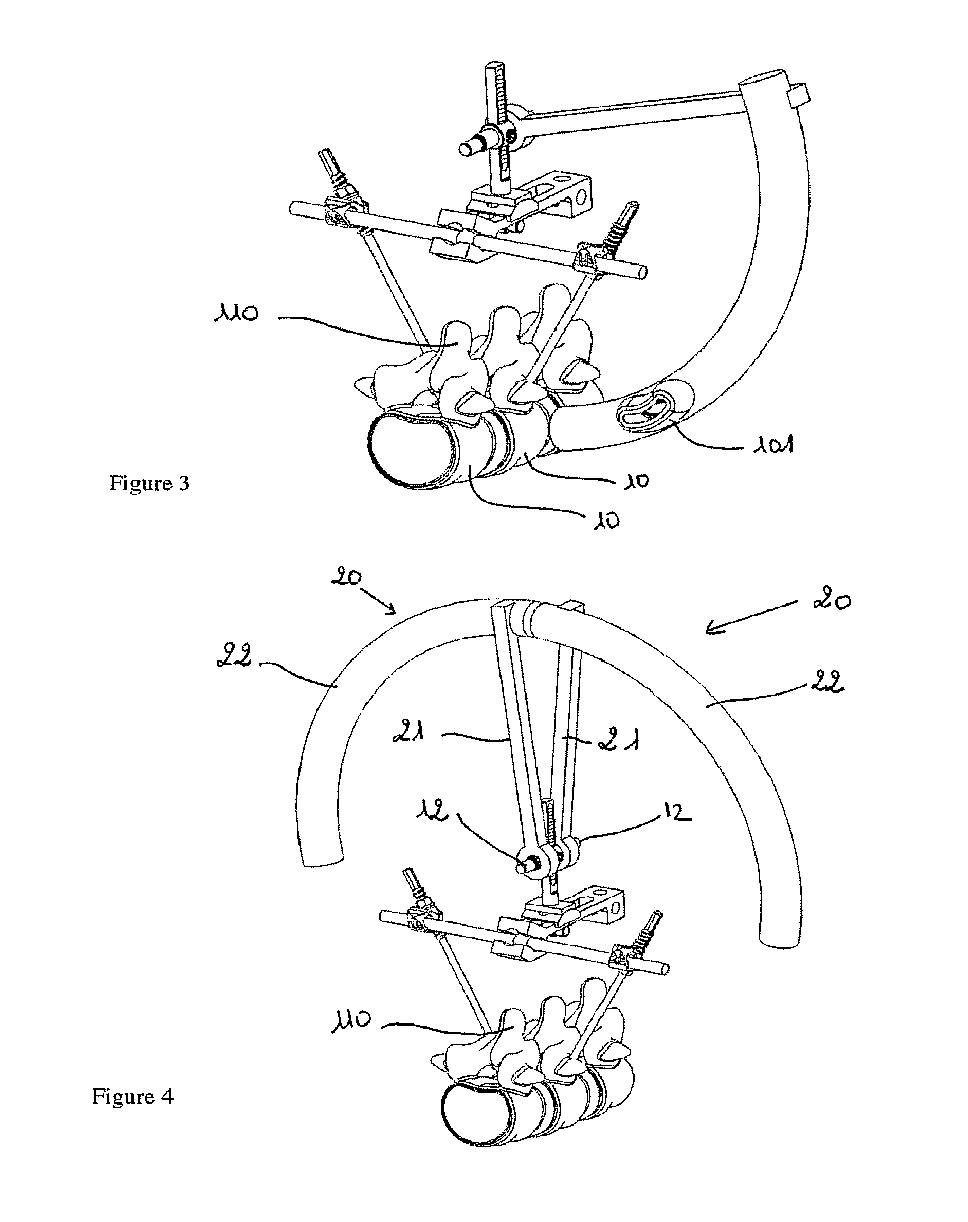 Device for establishing an anatomical reference point of an intervertebral disc