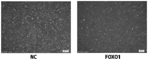 Transdifferentiation method of mesenchymal stem cells into sperms