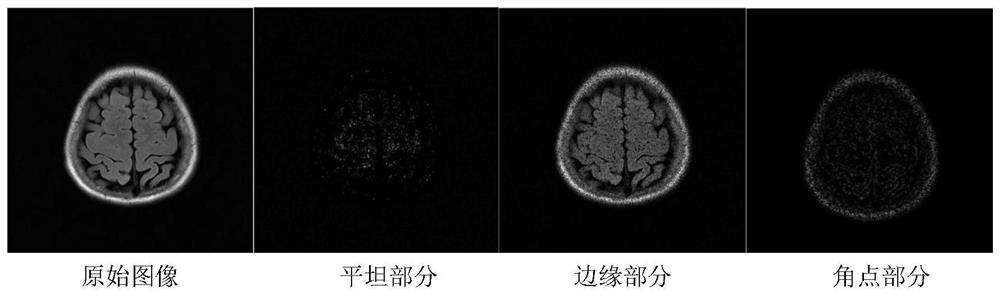 A method for denoising magnetic resonance images