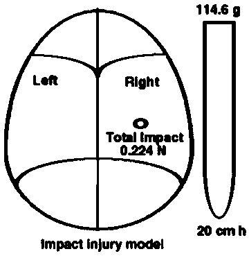 Application of butylphthalide or its derivatives in the preparation of medicines for treating or preventing concussion